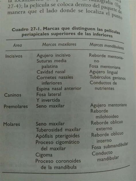 Pin De Amy Izquierdo En Odontolog A Odontolog A Anatom A Dental