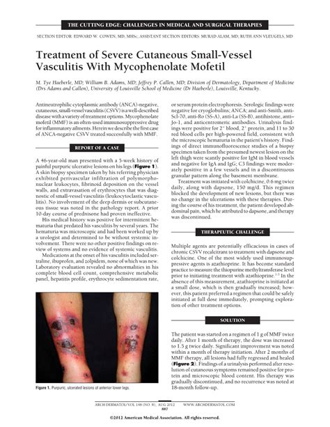 Treatment Of Severe Cutaneous Small Vessel Vasculitis With Mycophenolate Mofetil Dermatology