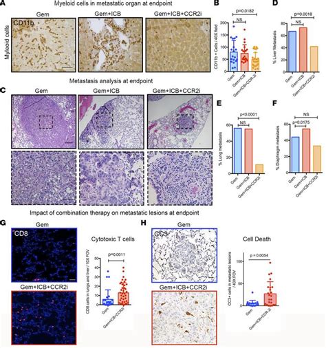 Jci Insight Targeting Tnf Producing Macrophages Activates Antitumor