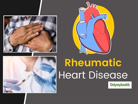 rheumatic heart disease symptoms Rheumatic symptoms - Diseases Club ...