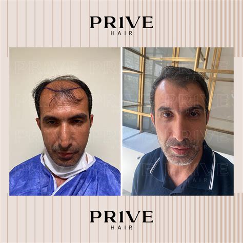 Prive Health Hair