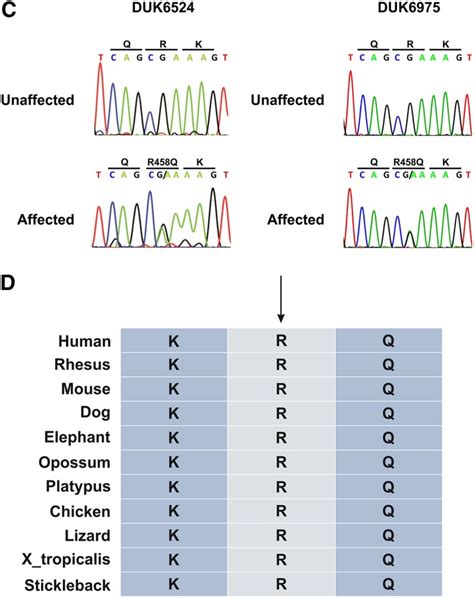 A Novel Missense Mutation Of Wilms Tumor 1 Causes Autosomal Dominant