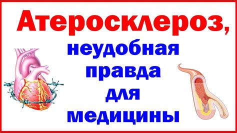 Атеросклероз, неудобная правда для медицины - Atherosclerosis, an ...