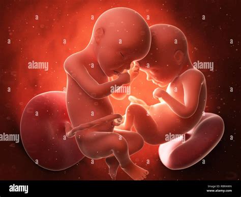 Twins Womb Hi Res Stock Photography And Images Alamy