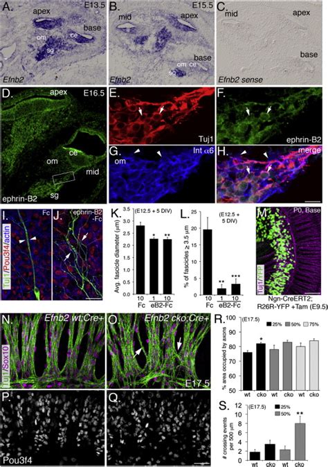 Otic Mesenchyme Cells Regulate Spiral Ganglion Axon Fasciculation