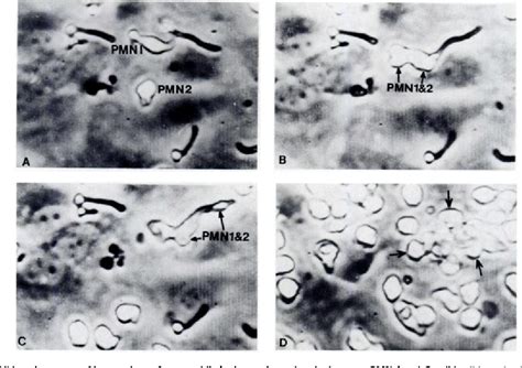 Figure 1 From Neutrophil Mediated Protection Of Cultured Human Vascular Endothelial Cells From