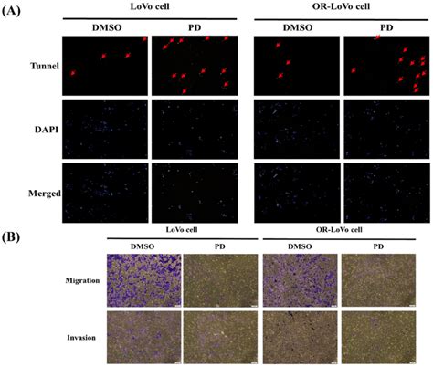 Pd Induces Apoptosis Invasion And Migration In Lovo And Oxp Lovo