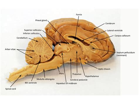 Sheep Brain Midsagittal Section Diagram Quizlet