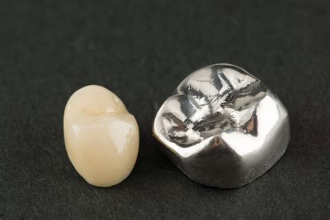 How Long Do Dental Crowns Last Empire Dental Care