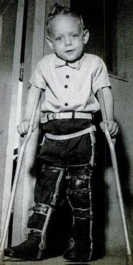 Pin By Dianne Dych On Polio 3 Leg Braces Scoliosis Brace Polio