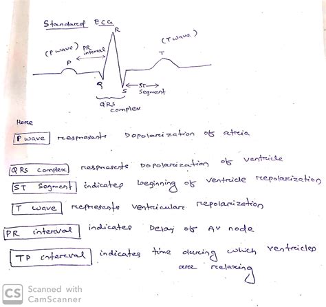 [solved] Draw A Standard Ecg Label Each Wave And Identify What Course Hero