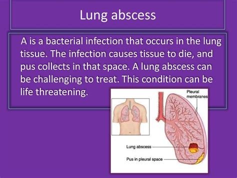 Lung Abscess