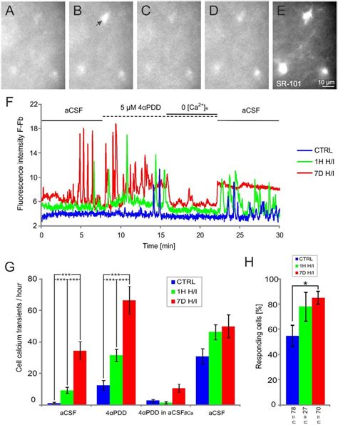 The TRPV4 Agonist 4aPDD Triggers Ca 2 Oscillations In Astrocytes Of