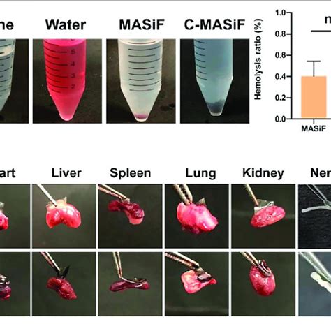 Hemocompatibility And Tissue Adhesion Property Of Masif And C Masif