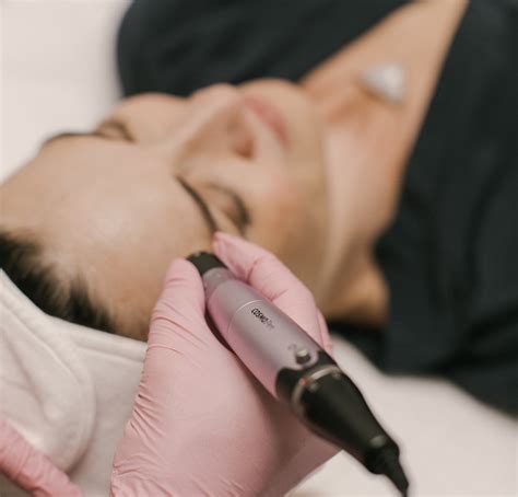 Treat Large Pores With Microneedling Skin Method