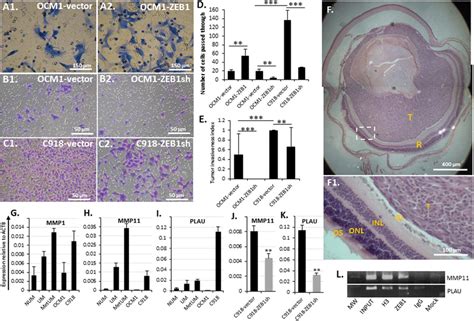 Zeb1 Promotes Um Cell Invasiveness Cells Passed Through The Transwell