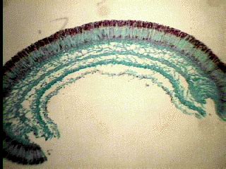 Peziza Under Microscope Labeled