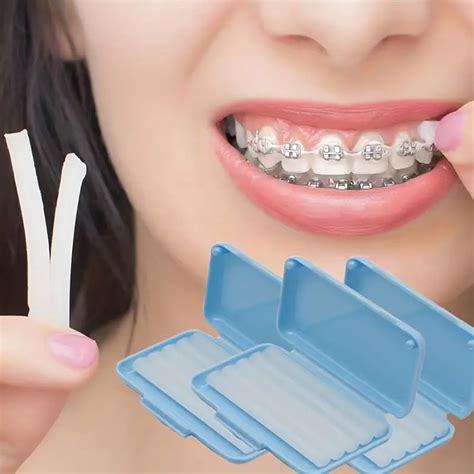 Expert Ways On How To Reduce Gap Between Teeth Naturally At Home