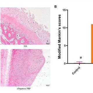 Histological Images And Analysis Of Articular Facet Femur Cartilage