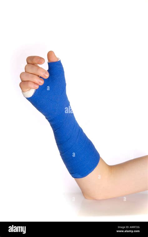 Wrist Cast Hi Res Stock Photography And Images Alamy