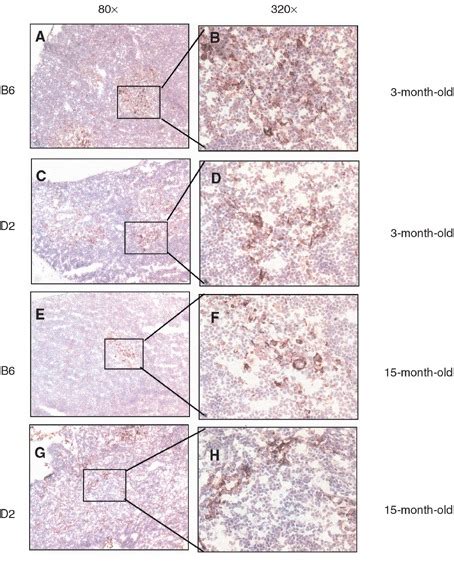 Thymic Involution In Dba2 D2 Mice Is Associated With Altered Mts