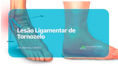 Cid Lesao Ligamento Tornozelo Braincp