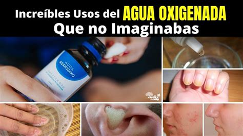 Incre Bles Usos Del Agua Oxigenada O Peroxido De Hidrogeno Que