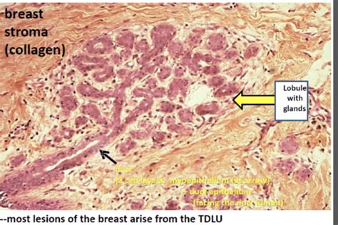 Gi Pathology Flashcards Quizlet