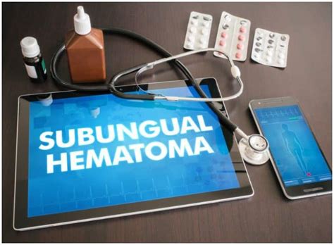 Subungual Hematoma Vs Melanoma Differences Health Guide Net