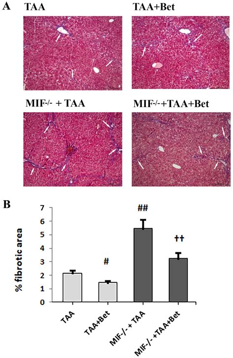 Biomedicines Free Full Text The Role Of Macrophage Inhibitory