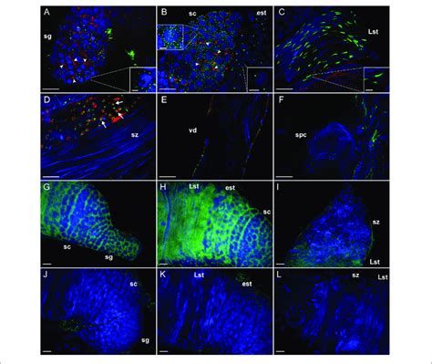 Immunohistochemical Localization And Transcript Detection By