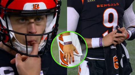 What Happened To Joe Burrows Finger Bengals Qb Suffers Brutal Injury