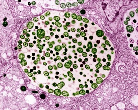 Chlamydia Inside Epithelial Cells Of The Oviduct Tem Stock Image