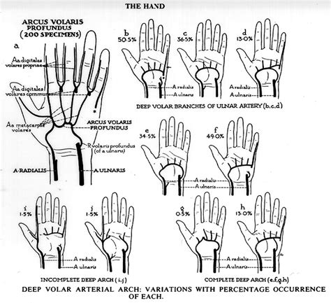 Palmar Arch Study