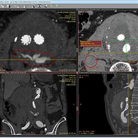 RadiAnt DICOM Viewer Alternatives and Similar Software - AlternativeTo.net