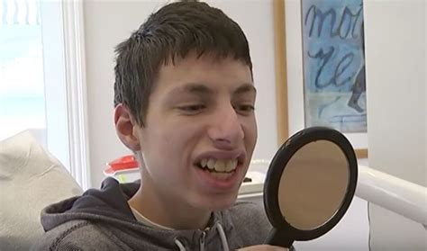 Kid With Buck Teeth Was Constantly Being Bullied - People Raised Money For Him To Get Surgery ...