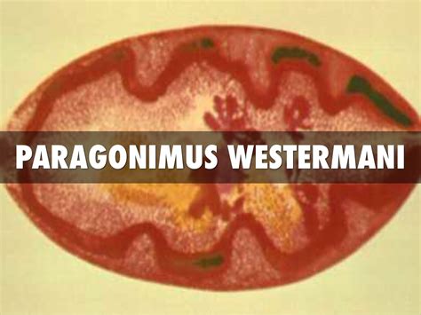 Paragonimus Westermani by Colby Ellis