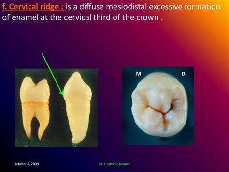 Anatomical Landmarks Of The Crown