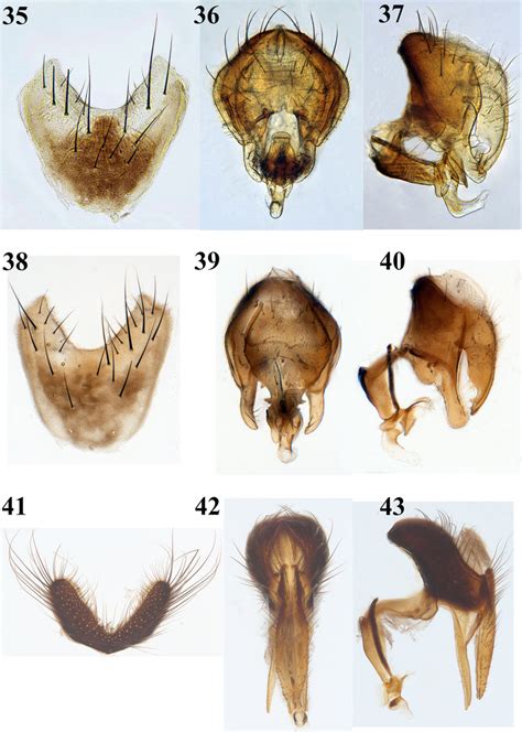 Coenosia Species Male Sternite 5 And Hypopygium Posterior And