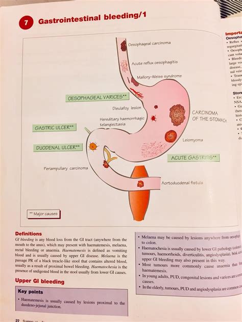 Upper Gi Bleeding Surgery Diagram Quizlet