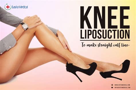 Pin On Liposuction