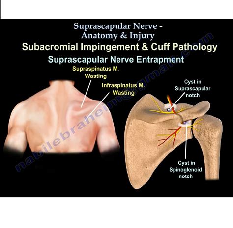 Suprascapular Nerve Anatomy —