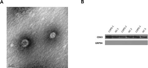 Figure 1 From Rna Sequencing And Bioinformatics Analysis Of Exosomal