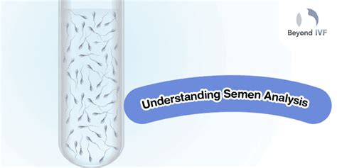 Semen Analysis Preparation Procedure And Understanding Results