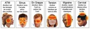 Chiropratique Et C Phal Es Comment Peut On Vous Aider Blogue