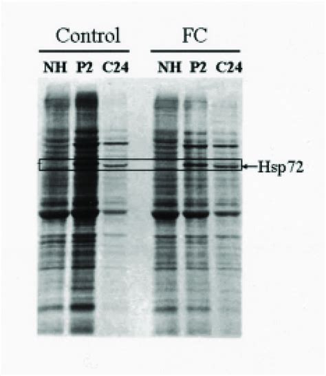 Comparison Of Newly Synthesized 35 S Methionine Labeled Polypeptides