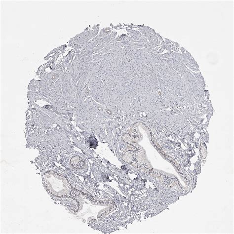 Tissue Expression Of Fas Staining In Cervix The Human Protein Atlas