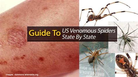 Guide To US Venomous Spiders State By State