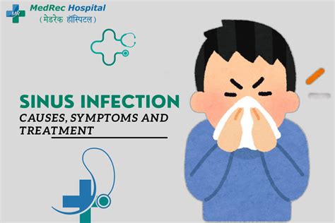 Sinus Infection: Causes, Symptoms, Prevention And Treatment