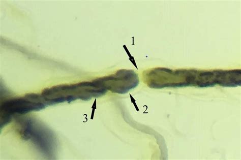 Th Group Sciatic Nerve Of Rat Loosening The Node Of Ranvier